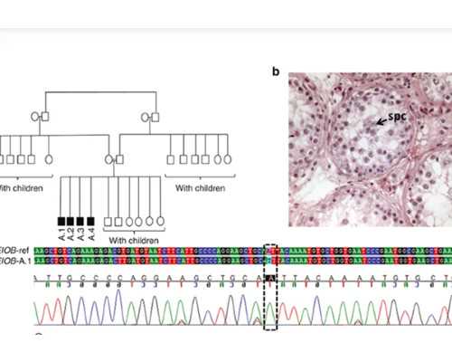 全国最好的代孕医院_,怀孕女人梦见鹿奔跑是预示生宝宝的胎梦吗？